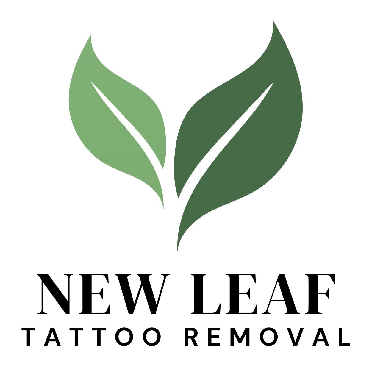 New Leaf Tattoo Removal